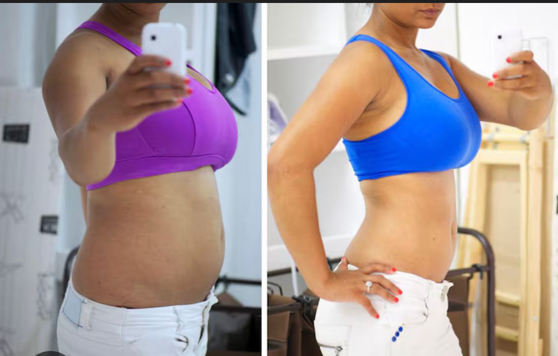 🔥 BURN EXTREME – El Mejor Suplemento Natural Para Adelgazar Rápido y Seguro